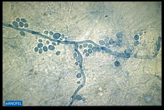C004