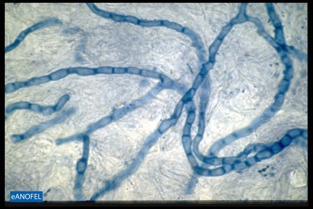 C005