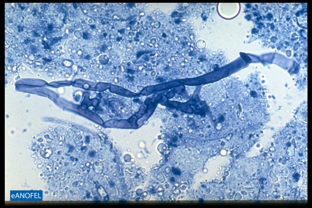 C006