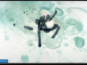C011