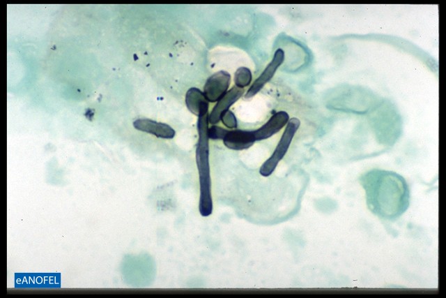 C011