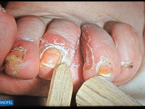 C022
