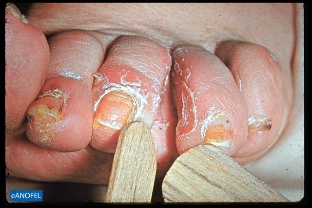 C022