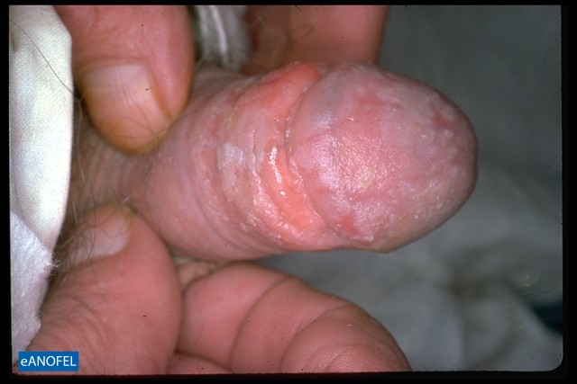 C025