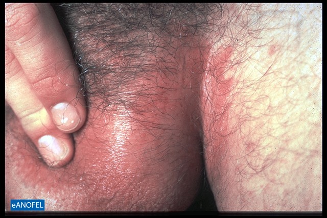 C026