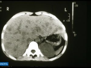 C030