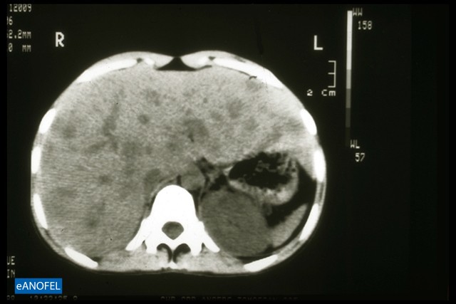C030