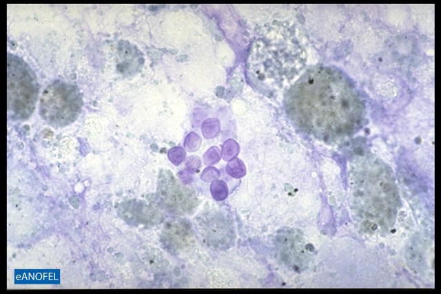 C099