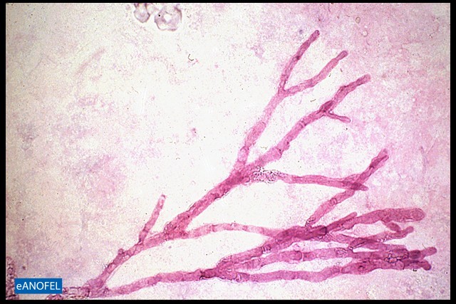 C197