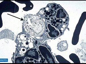 C255