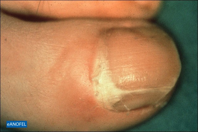 C346