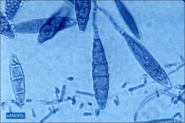 C385