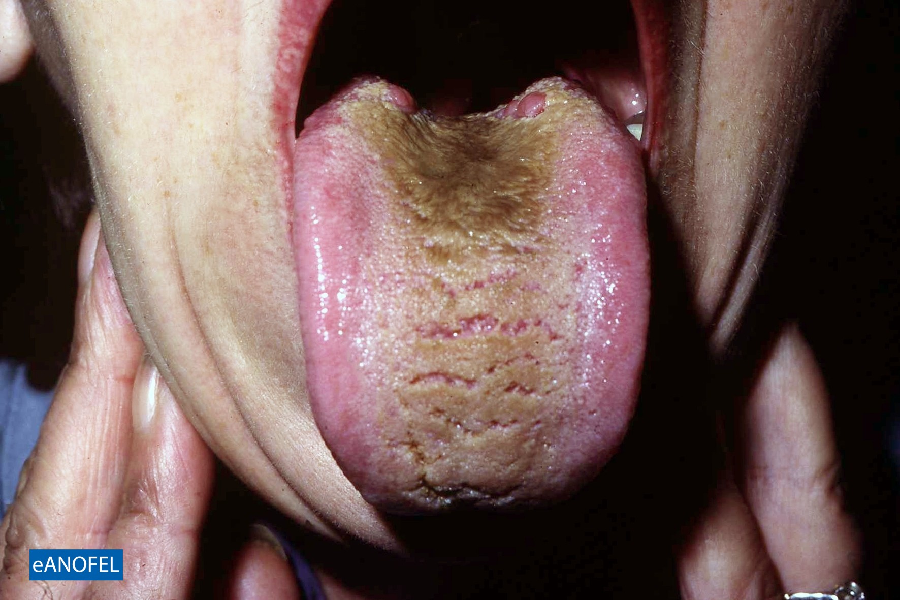 C738