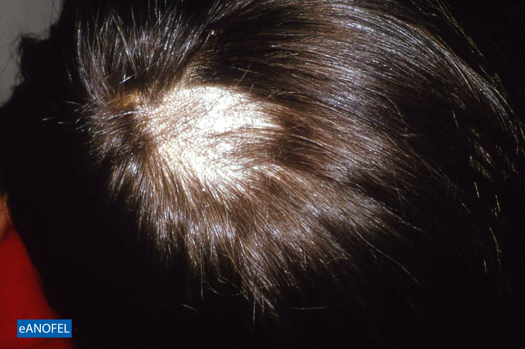 C746
