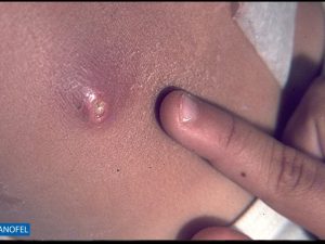 E039