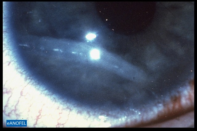 E050