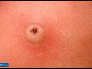 E093
