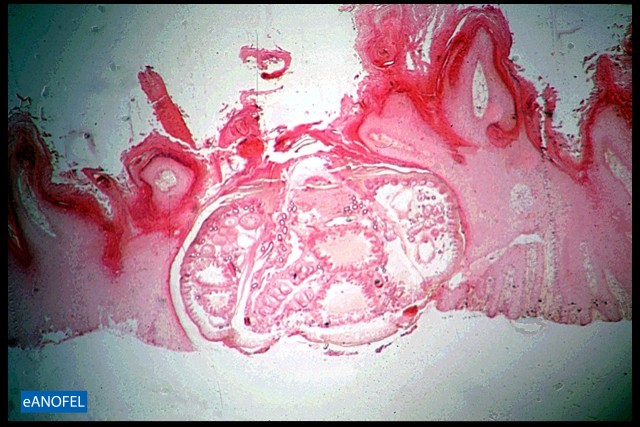 E095