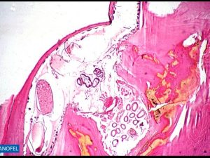 E096