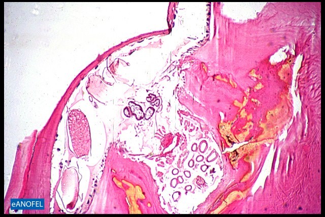 E096