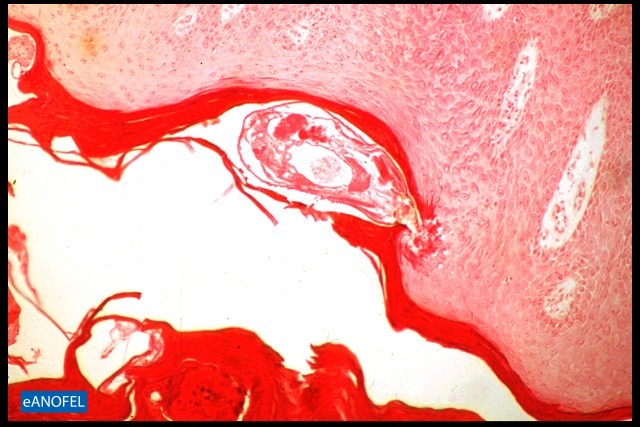 E115