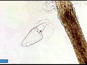 E119