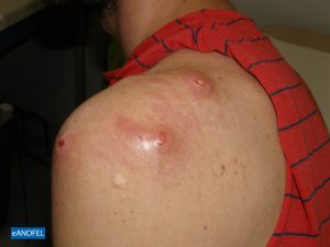 E288