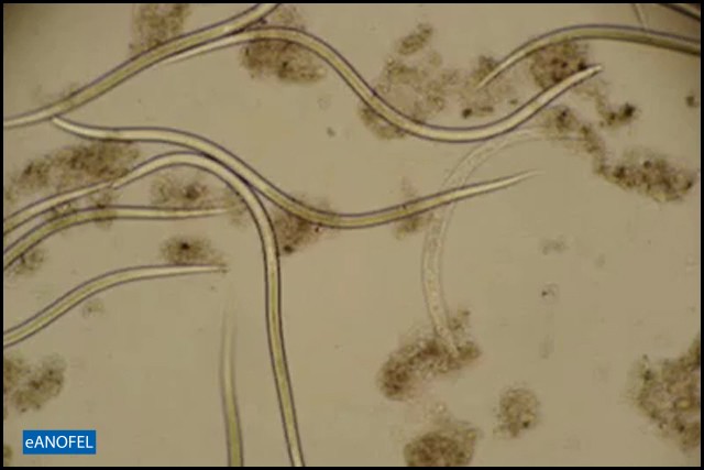F006