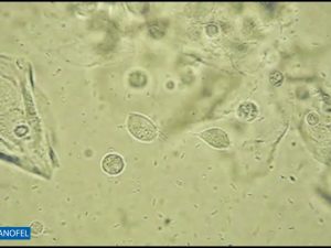 F009
