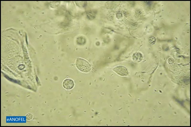 F009