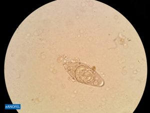 F036