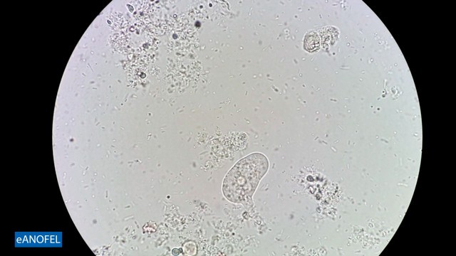 F050