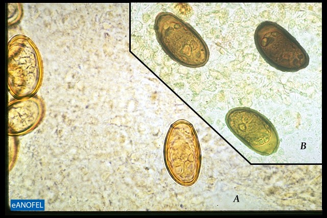 H057