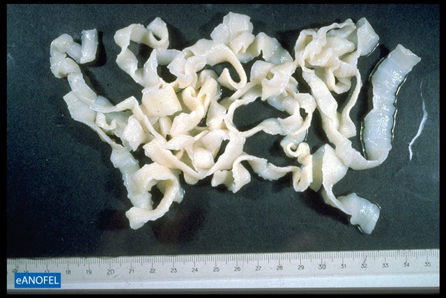 H076