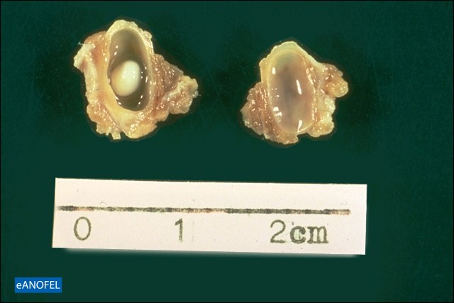 H086