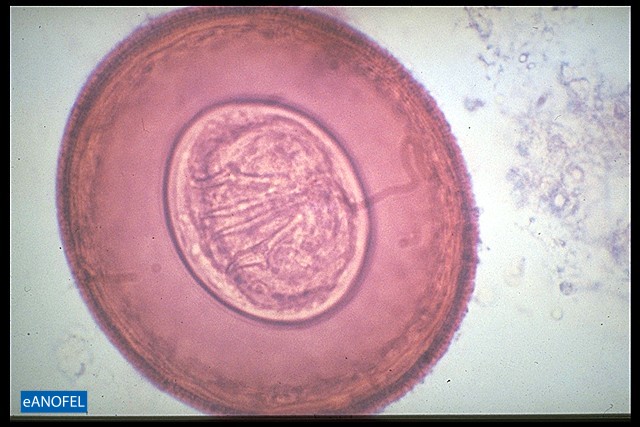 H091