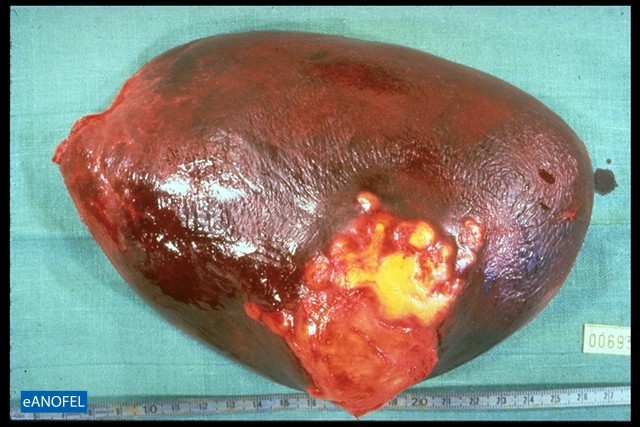 H105