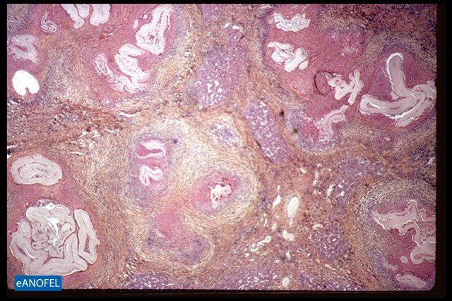 H107