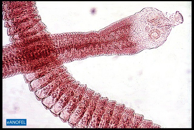 H114