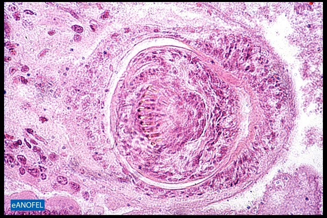 H116