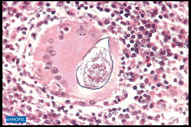 H143