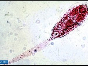 H151