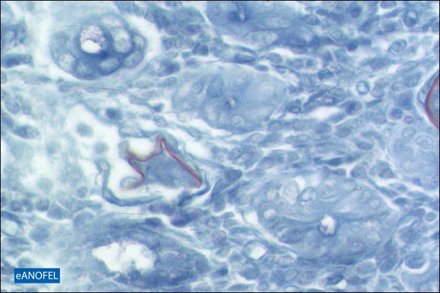H253
