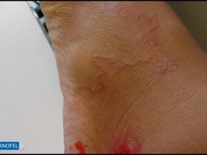 H502