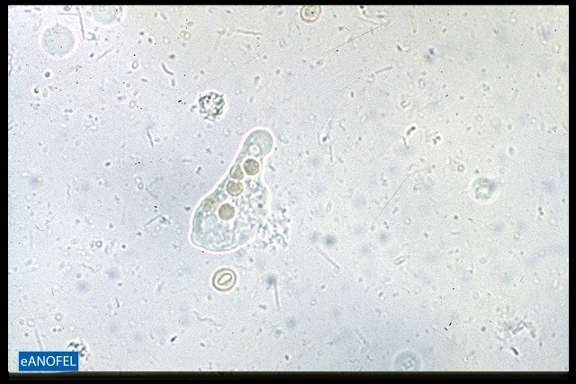 P002