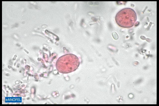 P013