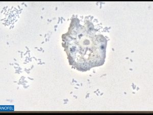 P014