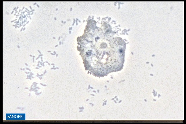 P014