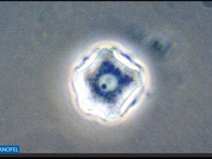 P015