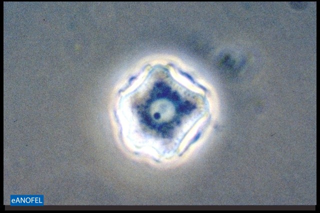 P015